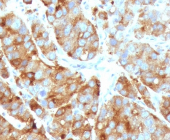 KRT15 Antibody / Cytokeratin 15
