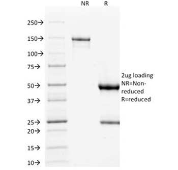 p53 Antibody / TP53