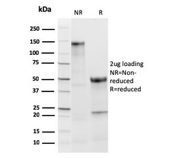 Thyroid Peroxidase Antibody