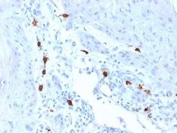 TPSAB1 Antibody / Mast Cell Tryptase