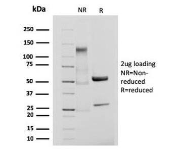 Integrin beta 3 Antibody / ITGB3 / CD61