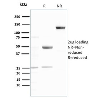 Ubiquitin Antibody