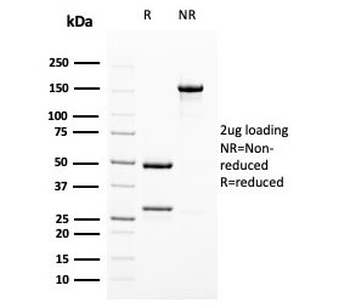 Uroplakin 1B Antibody / UPK1B