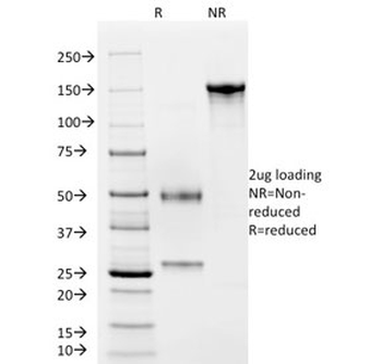 von Willebrand Factor Antibody / vWF