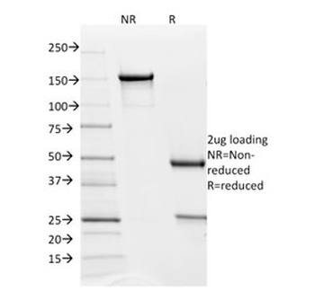PD-L2 Antibody / Programmed death ligand 2 / CD273