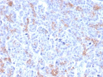 ABCC3 Antibody / MRP3