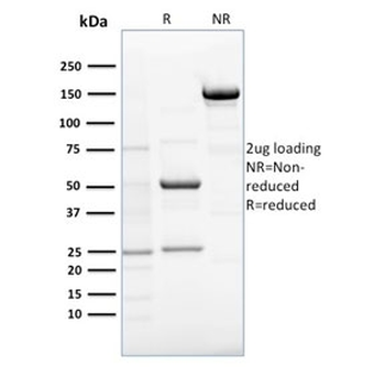 EBAG9 Antibody / Estrogen Receptor Binding Site Associated Antigen 9