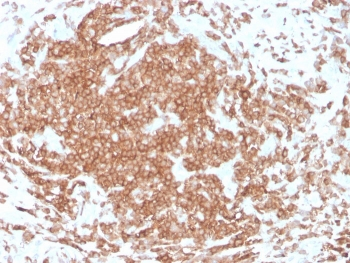 CD3 epsilon Antibody
