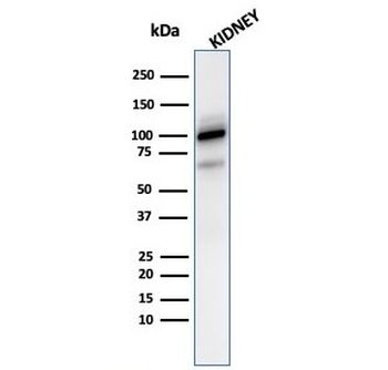 CD10 Antibody / Neprilysin