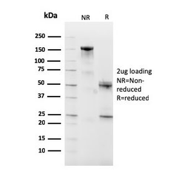 CD10 Antibody / Neprilysin