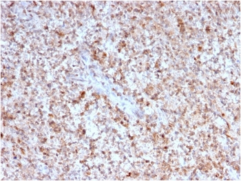 CD40L Antibody / TRAP / CD154