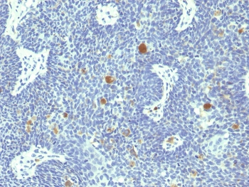 HPV18 E6 Antibody
