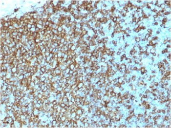 Pan-HLA Antibody (MHC II)