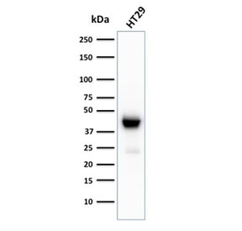 Cytokeratin 20 Antibody / CK20