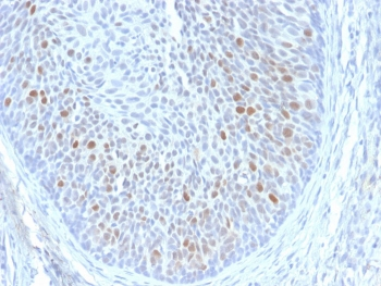 HPV-16 E1/E4 Antibody