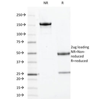TOP1MT Antibody / Topoisomerase I mitochondrial