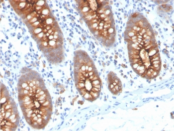 CEA Antibody / Carcinoembryonic Antigen