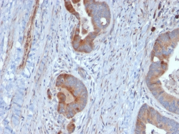 Keratin 6B Antibody / Cytokeratin 6B