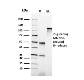 Keratin 6B Antibody / Cytokeratin 6B