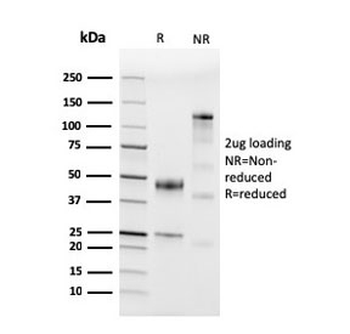 CD45 Antibody (Leukocyte marker)