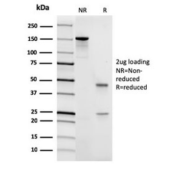 CD45 Antibody (Leukocyte marker)