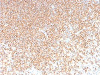 CD45RA Antibody (Leukocyte marker)