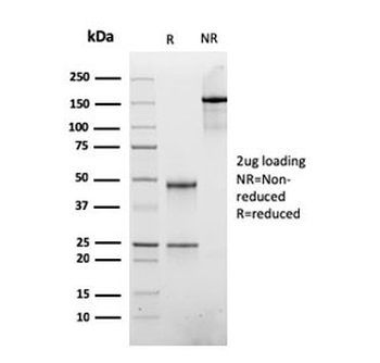 ATRX Antibody / RAD54