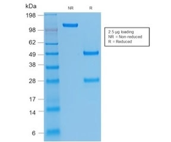 Integrin beta 3 Antibody / ITGB3 / CD61