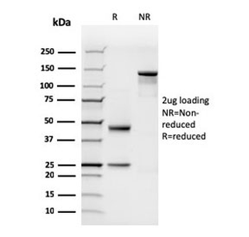 N-Cadherin Antibody / CDH2