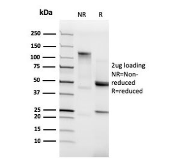 N-Cadherin Antibody / CDH2