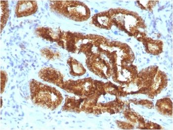 AMACR / p504S Antibody (Prostate Cancer Marker)