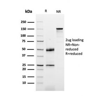 Dystrophin Antibody / DMD