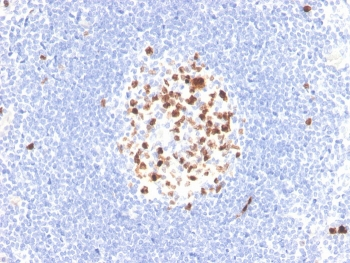 Topoisomerase II alpha Antibody / TOP2A