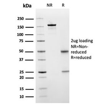 SERBP1 Antibody / PAI-RBP1