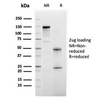 BAP1 Antibody / BRCA1 Associated Protein 1