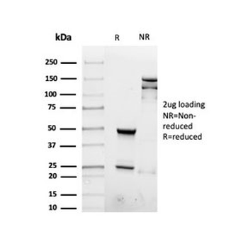 Interferon gamma Antibody / IFNG