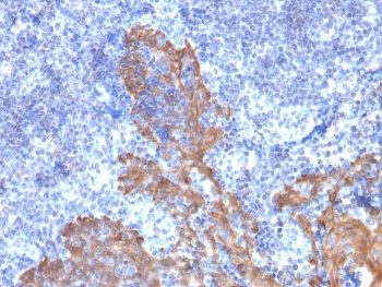 Cytokeratin 5/6 Antibody