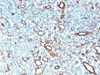 Collagen IV Antibody / COL4A