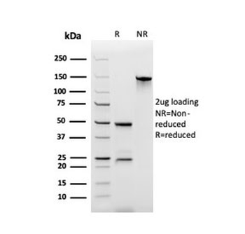 Secretory Component p85 Antibody / ECM1