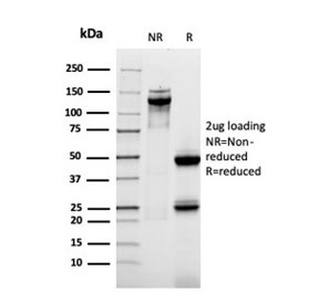 MUC1 Antibody / Mucin-1