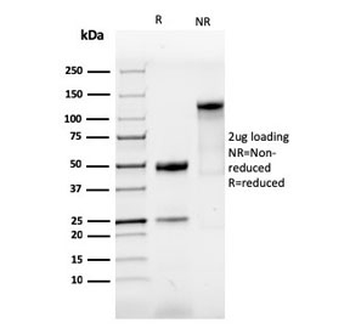 SOX9 Antibody / SRY-box 9