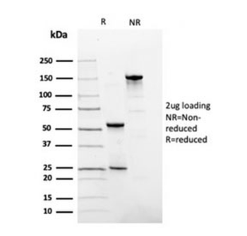 FN1 Antibody / Fibronectin