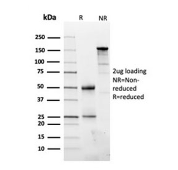 FN1 Antibody / Fibronectin