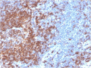 CD22 Antibody / BL-CAM