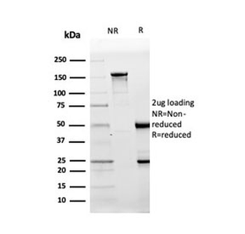 CD10 Antibody / Neprilysin