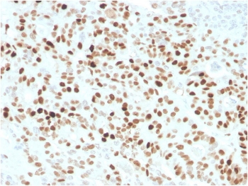 p21 Antibody / CDKN1A
