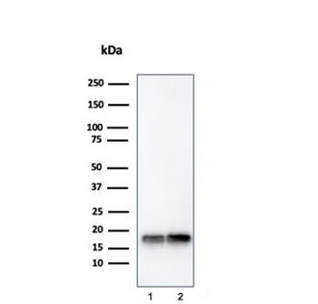 SOD1 Antibody / Superoxide Dismutase 1