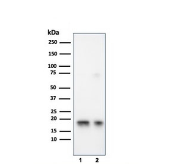 SOD1 Antibody / Superoxide Dismutase 1