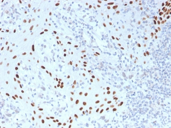 p40 / deltaNp63 Antibody
