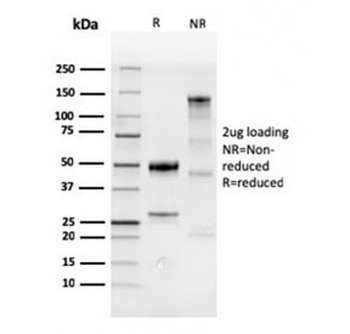 CDX2 Antibody